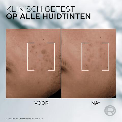 L'Oreal Men Expert Derma Control Serum 30ML