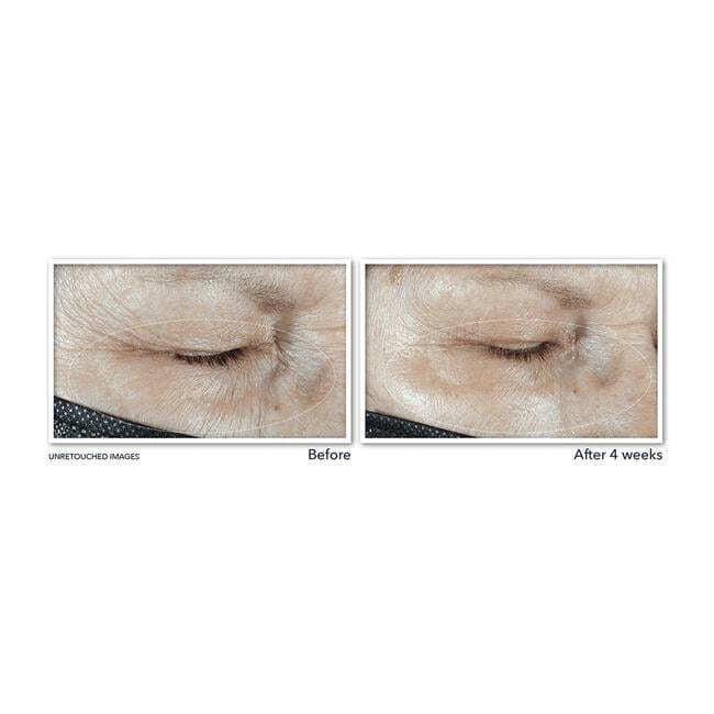 RoC Multi-Correxion Hydrate & Plump Eye Gel Cream 15 ML