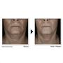RoC Derm Correxion Contour Cream 50 ML