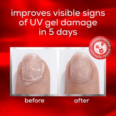 essie Care To The Rescue Nagelverzorging Herstelt Nagels van UV-gelschade 13.5 ML