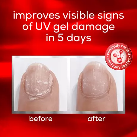 essie Care To The Rescue Nagelverzorging Herstelt Nagels van UV-gelschade