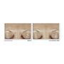 RoC Derm Correxion Fill + Treat Serum 15 ML