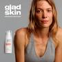 Gladskin Acne Gel 15 ML