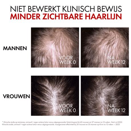 Vichy Dercos Aminexil Regenerating Serum 90 ML