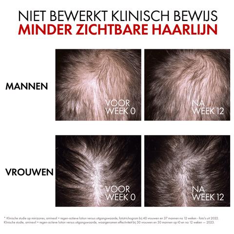 Vichy Dercos Aminexil Regenerating Serum 90 ML