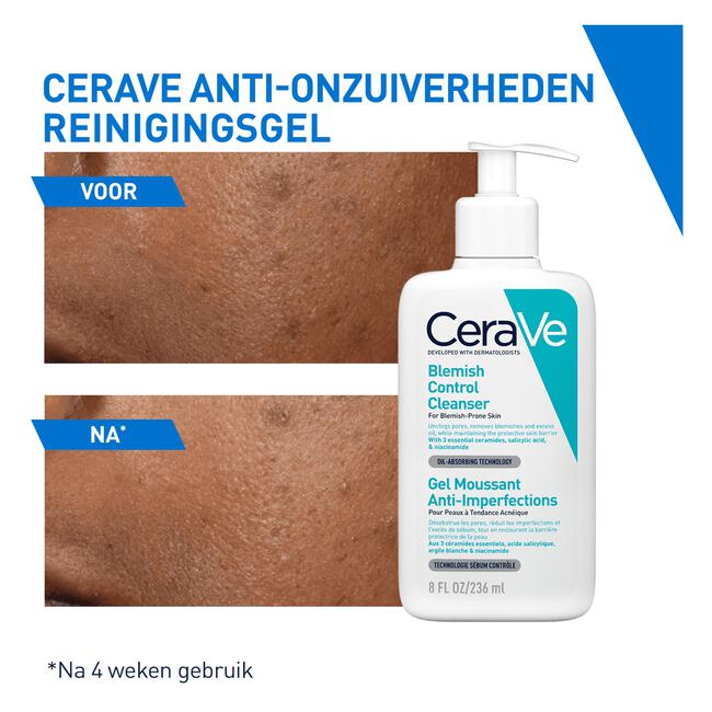 CeraVe Anti-Onzuiverheden Reinigingsgel 473 ML