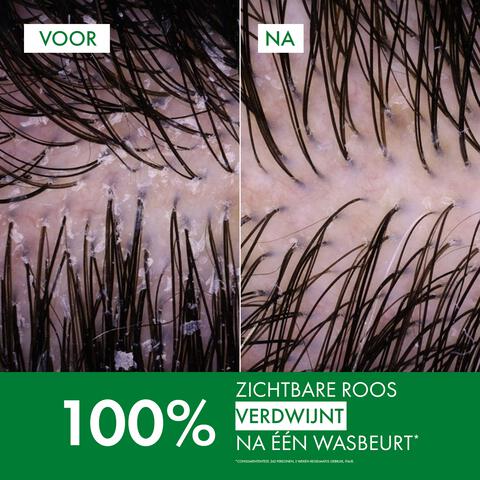 Vichy Dercos Anti-Roos DS Shampoo NH/VH Navulling 390 ML