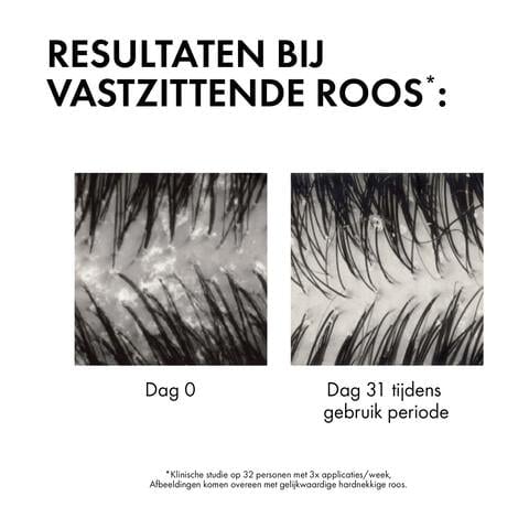 Vichy Dercos Anti-Roos DS Shampoo DH Navulling 390 ML