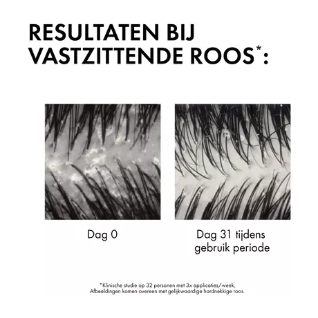 Vichy Dercos Anti-Roos DS Shampoo DH Navulling 390 ML