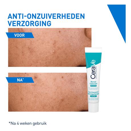 CeraVe Anti-Onzuiverheden Verzorging 40 ML