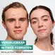 Garnier Pure Active Pimple Patch 22 stuks