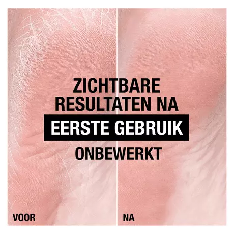 Neutrogena Voedende Voetcreme 100 ML