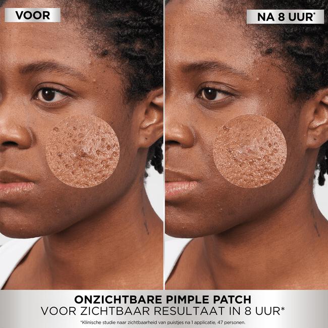 Garnier Pure Active Pimple Patch 22 stuks