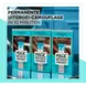 L'Oréal Paris Magic Retouch Permanente Haarverf 5 Lichtbruin