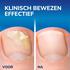 Dr.Scholl's Kalknagel 2 in 1 Behandel en Beschermset met 5 wegwerpvijltjes 3,8 ML