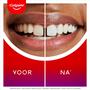 Colgate Max White Ultimate Whitening Tandpasta - 75 ML