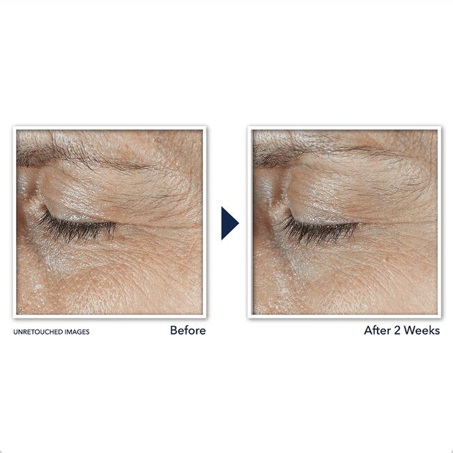 RoC Derm Correxion Dual Eye 20 ML