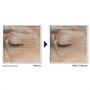 RoC Derm Correxion Dual Eye 20 ML