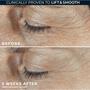 RoC Derm Correxion Dual Eye 20 ML