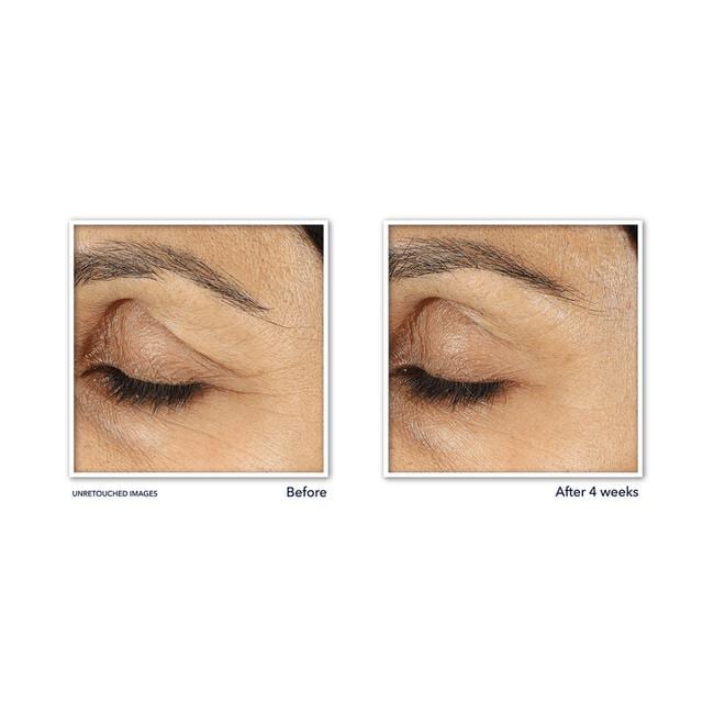 Roc Retinol Correxion Line Smoothing Eye Cream 15 ML