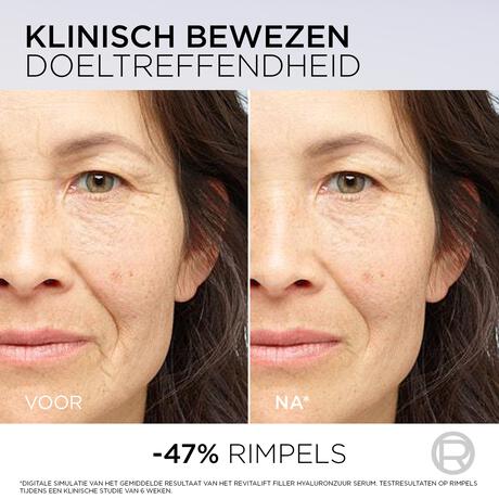 L'Oréal Paris Revitalift Filler Anti-Rimpel Volumegevend Serum met PDRN 30 ML