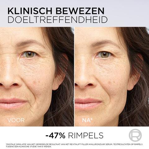 L'Oréal Paris Revitalift Filler Anti-Rimpel Volumegevend Serum met PDRN 30 ML