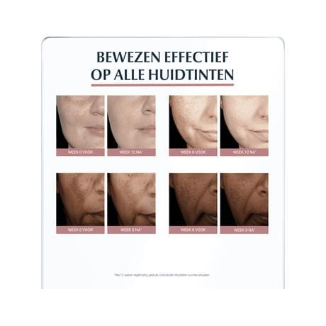 Eucerin Anti-Pigment Nachtcrème 50 ML