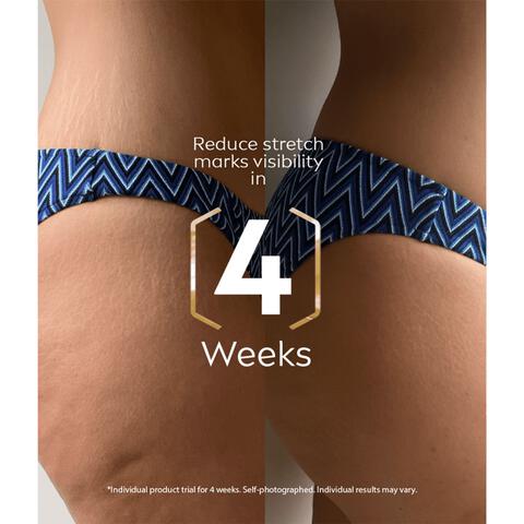 NIVEA Luminous630 Anti-Striae Lichaamsolie-serum 100 ML