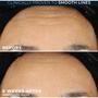 Roc Retinol Correxion Line Smoothing Night Serum 30 capsules
