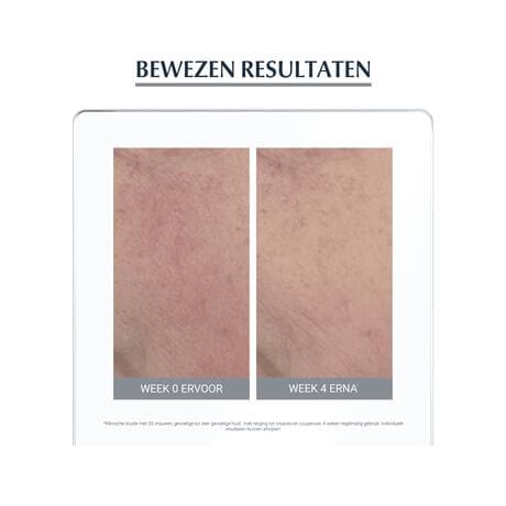 Eucerin AntiREDNESS Kalmerende Crème 50 ML