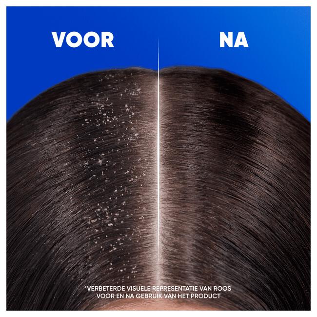 Head & Shoulders Classic Anti-roos Shampoo 625 ML