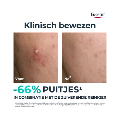Eucerin DERMOPURE CLINICAL Triple Action Fluid Serum Gevoelige Huid 40 ML