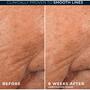 Roc Retinol Correxion Line Smoothing Night Serum 30 capsules