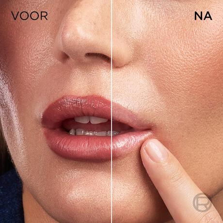 L'Oréal Paris Revitalift Filler Anti-Rimpel Volumegevend Serum met PDRN 30 ML