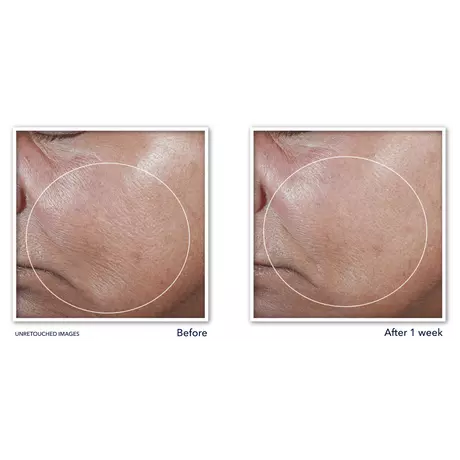 RoC Derm Correxion Firming Serum Stick