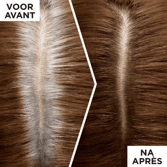 L'Oréal Paris Magic Retouch Camouflerende Uitgroeispray Middenbruin 75 ML