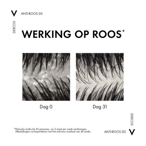 Vichy Dercos Anti-Roos Shampoo Droog Haar 200 ML