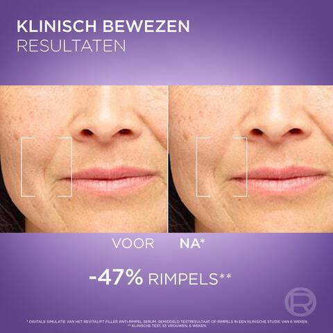L'Oréal Paris Revitalift Filler 1,5% Hyaluronzuur Serum 30ML