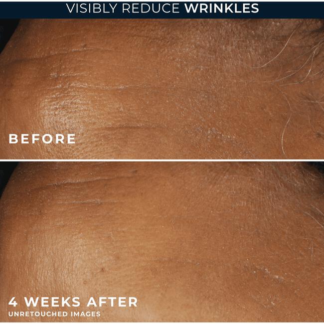 Roc Retinol Correxion Wrinkle Correct Moisturizer SPF30 30 ML