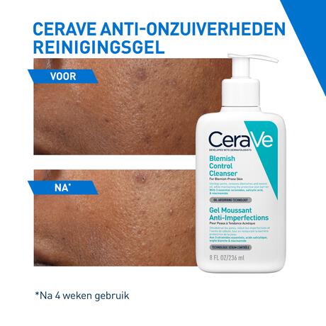 CeraVe Anti-Onzuiverheden Reinigingsgel 473 ML