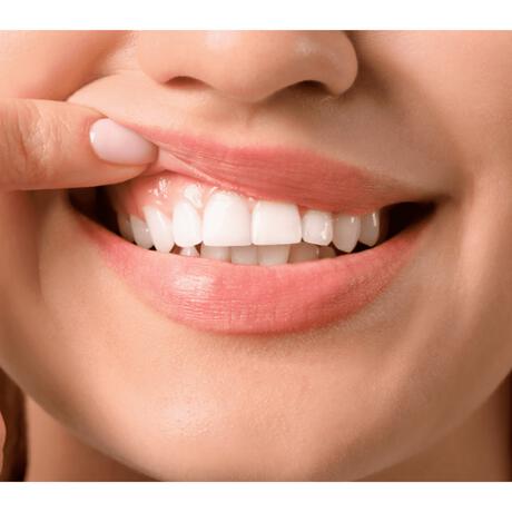 VITIS Gezond Tandvlees Tandpasta - 75ML