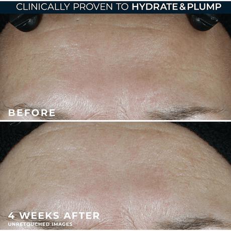 RoC Multi-Correxion Hydrate & Plump Moisturiser SPF30 50 ML