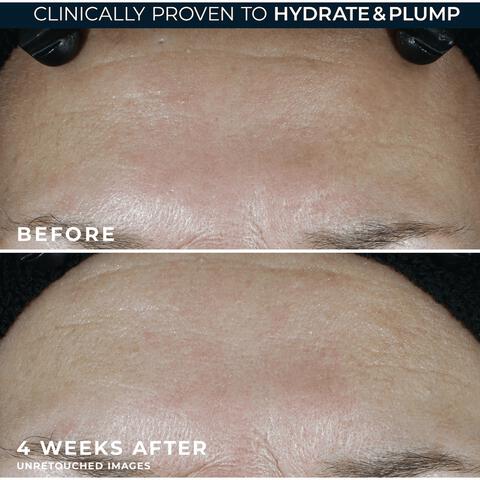 RoC Multi-Correxion Hydrate & Plump Moisturiser SPF30 50 ML