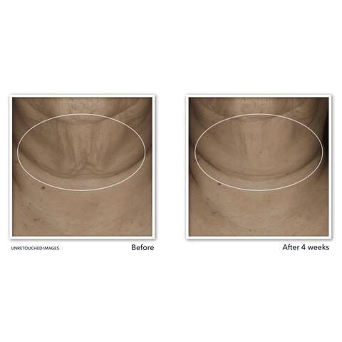 RoC Derm Correxion Firming Serum Stick