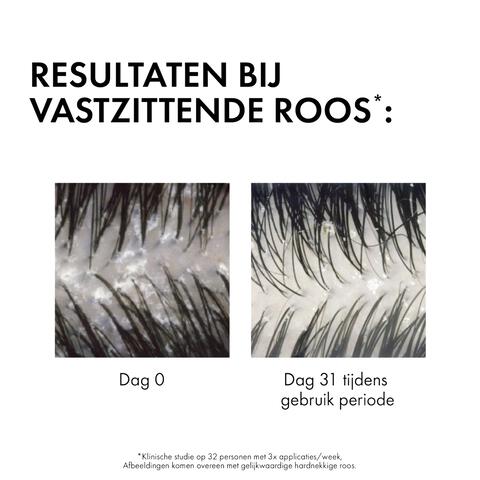 Vichy Dercos Anti-Roos DS Shampoo DH Navulling 390 ML
