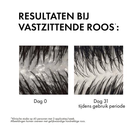 Vichy Dercos Anti-Roos Shampoo 200 ML