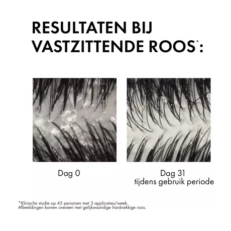 Vichy Dercos Anti-Roos Shampoo 200 ML