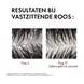 Vichy Dercos Anti-Roos Shampoo 200 ML
