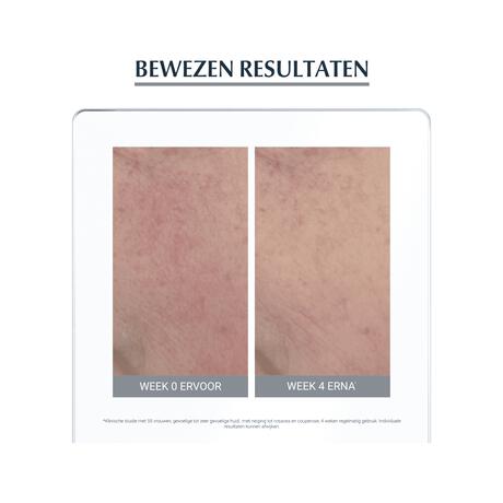 Eucerin AntiREDNESS Corrigerende Crème 50 ML