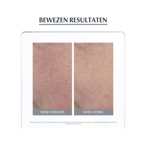 Eucerin AntiREDNESS Corrigerende Crème 50 ML